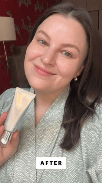 Singh after applying the Medik8 Crystal Retinal 6